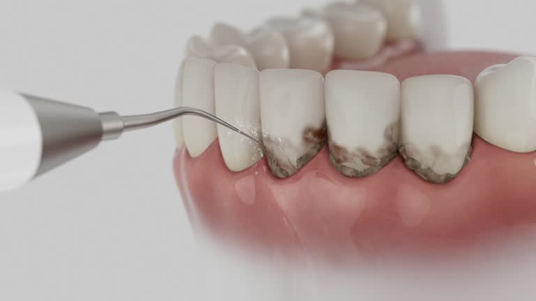 Reliable Dental Implants contractor in Brule County County, SD by Dentist Open Now